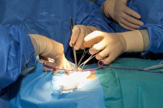 El Hospital de La Candelaria pone en marcha un nuevo circuito sin hospitalizaci&oacute;n para la cirug&iacute;a de tiroides